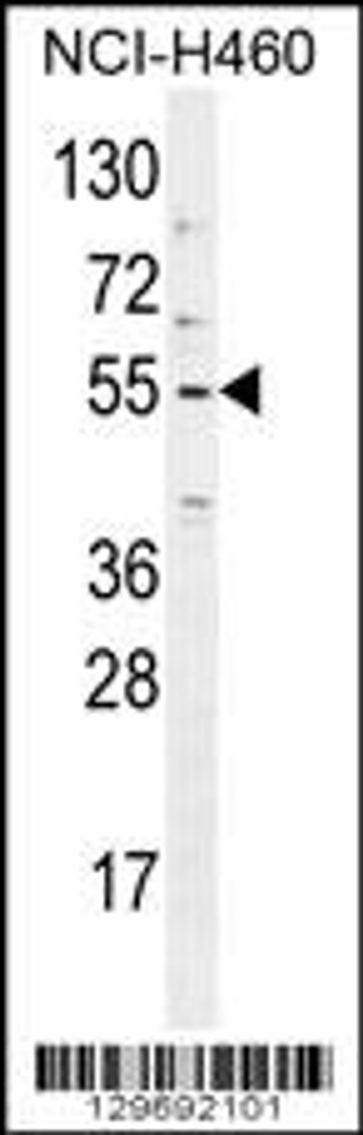 Western blot analysis in NCI-H460 cell line lysates (35ug/lane) .