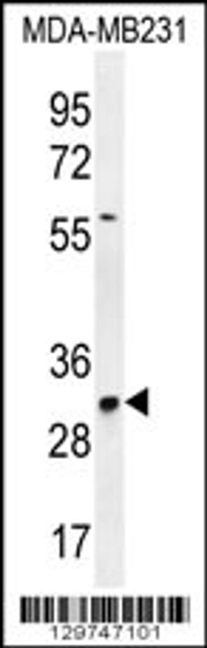 Western blot analysis in MDA-MB231 cell line lysates (35ug/lane) .