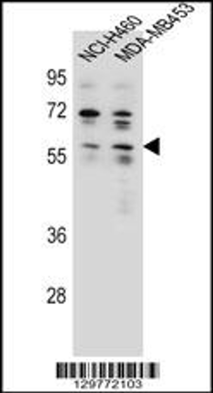 Western blot analysis in NCI-H460, MDA-MB453 cell line lysates (35ug/lane) .