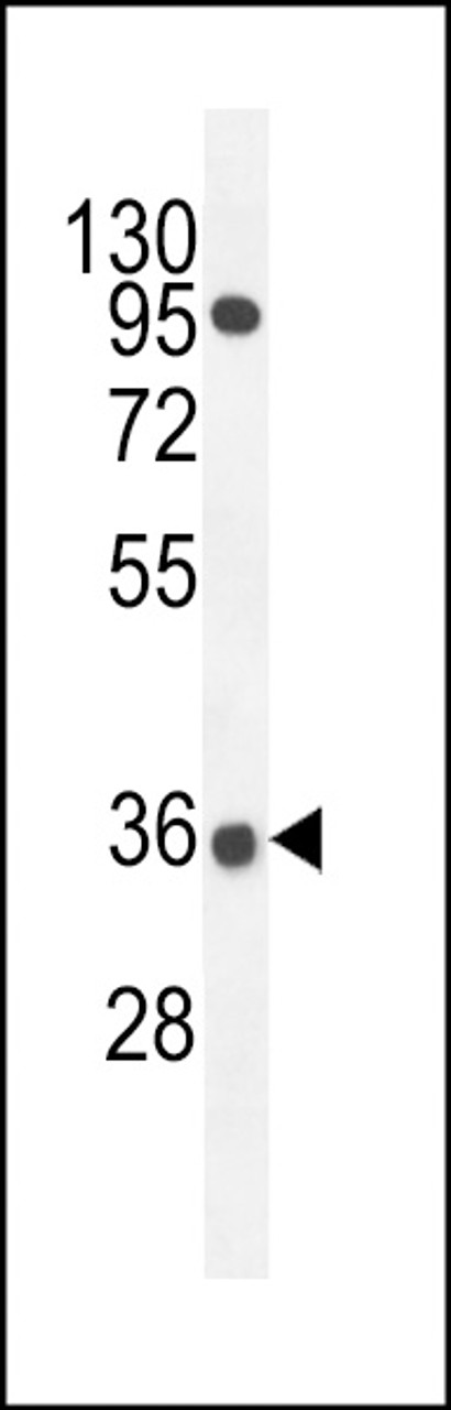 Western blot analysis in A549 cell line lysates (35ug/lane) .