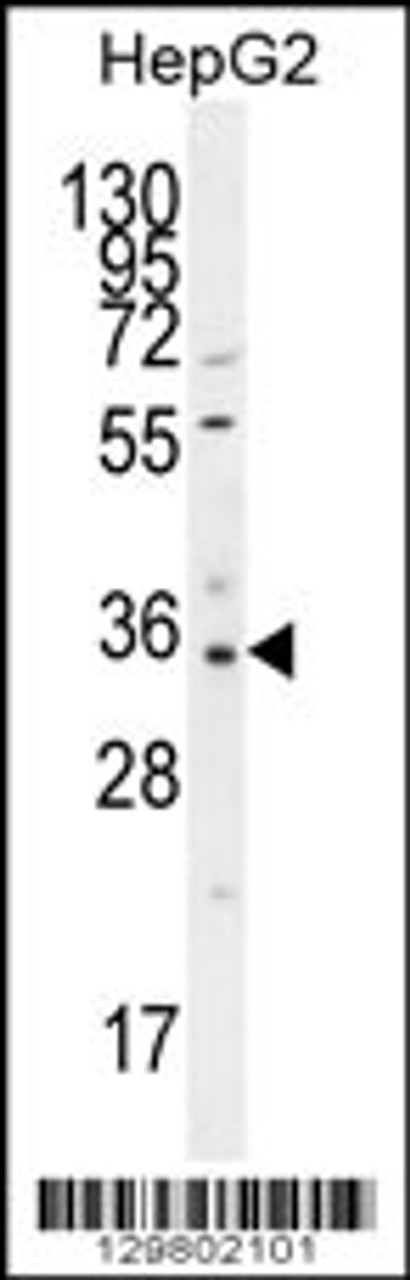 Western blot analysis in HepG2 cell line lysates (35ug/lane) .