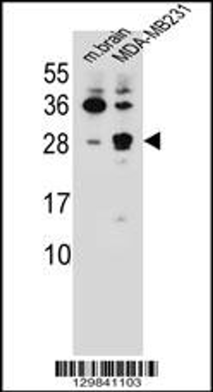 Western blot analysis in mouse brain tissue and MDA-MB231 cell line lysates (35ug/lane) .