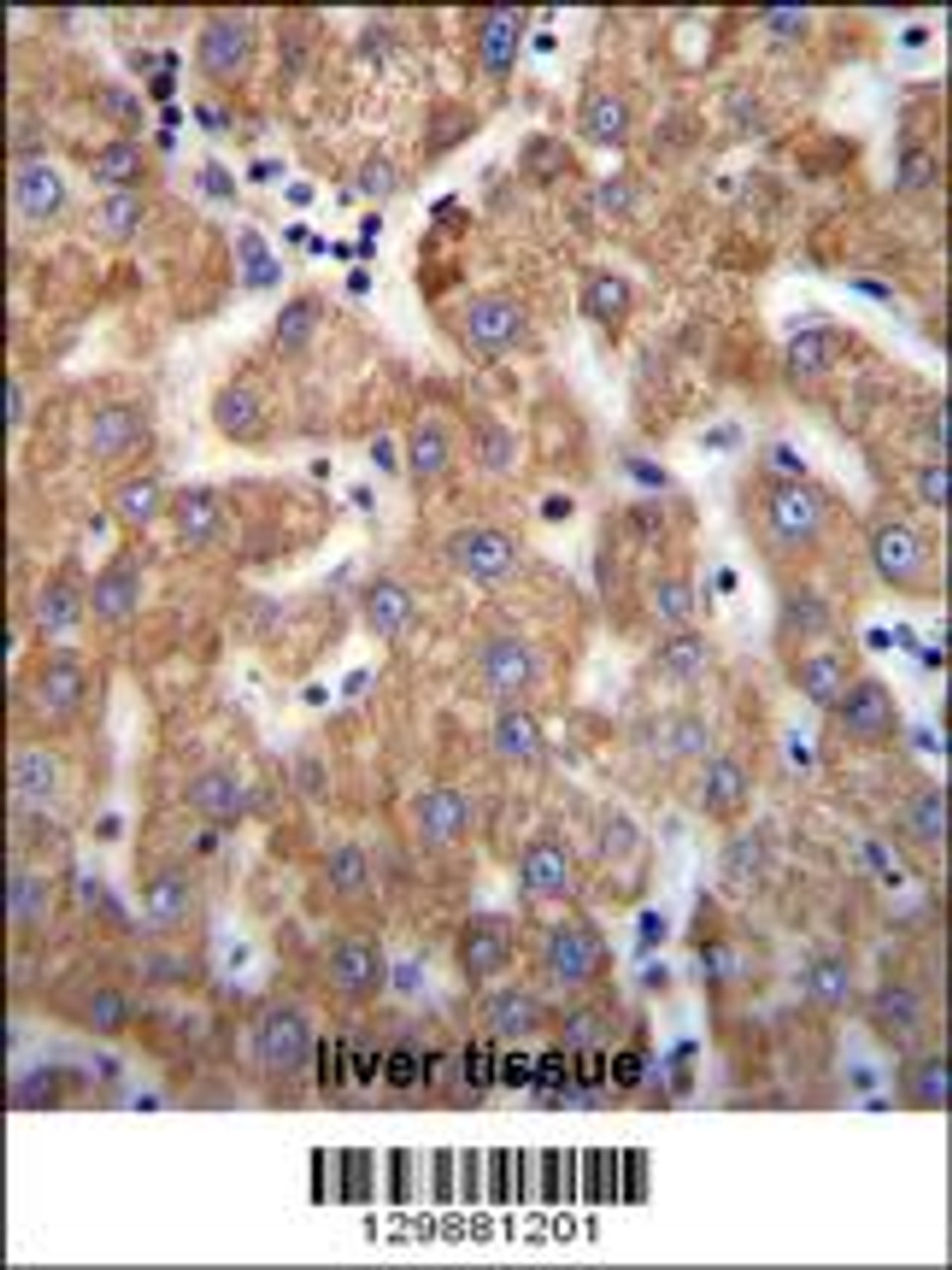 ANKRD58 Antibody immunohistochemistry analysis in formalin fixed and paraffin embedded human liver tissue followed by peroxidase conjugation of the secondary antibody and DAB staining.