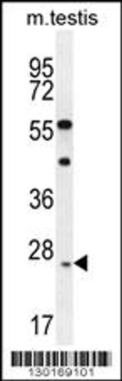 Western blot analysis in mouse testis tissue lysates (35ug/lane) .