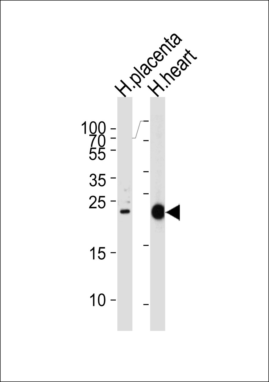 Western blot analysis of lysates from human placenta and heart tissue lysates (from left to right) , using FRAT2 Antibody at 1:1000 at each lane.