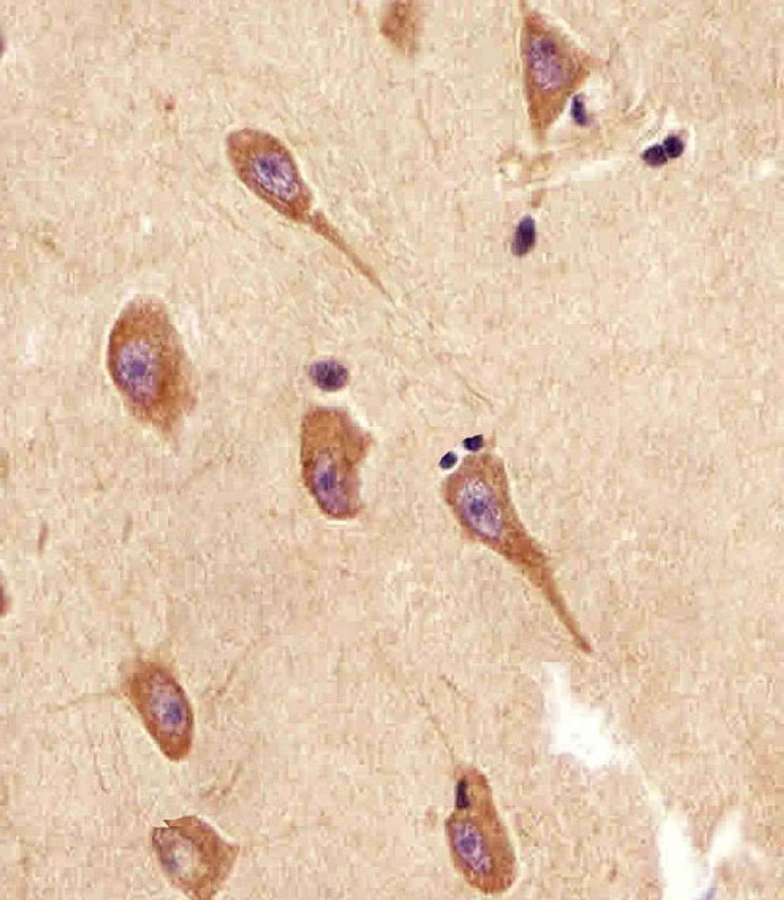Antibody staining TGFBR2 in human brain sections by Immunohistochemistry (IHC-P - paraformaldehyde-fixed, paraffin-embedded sections) .