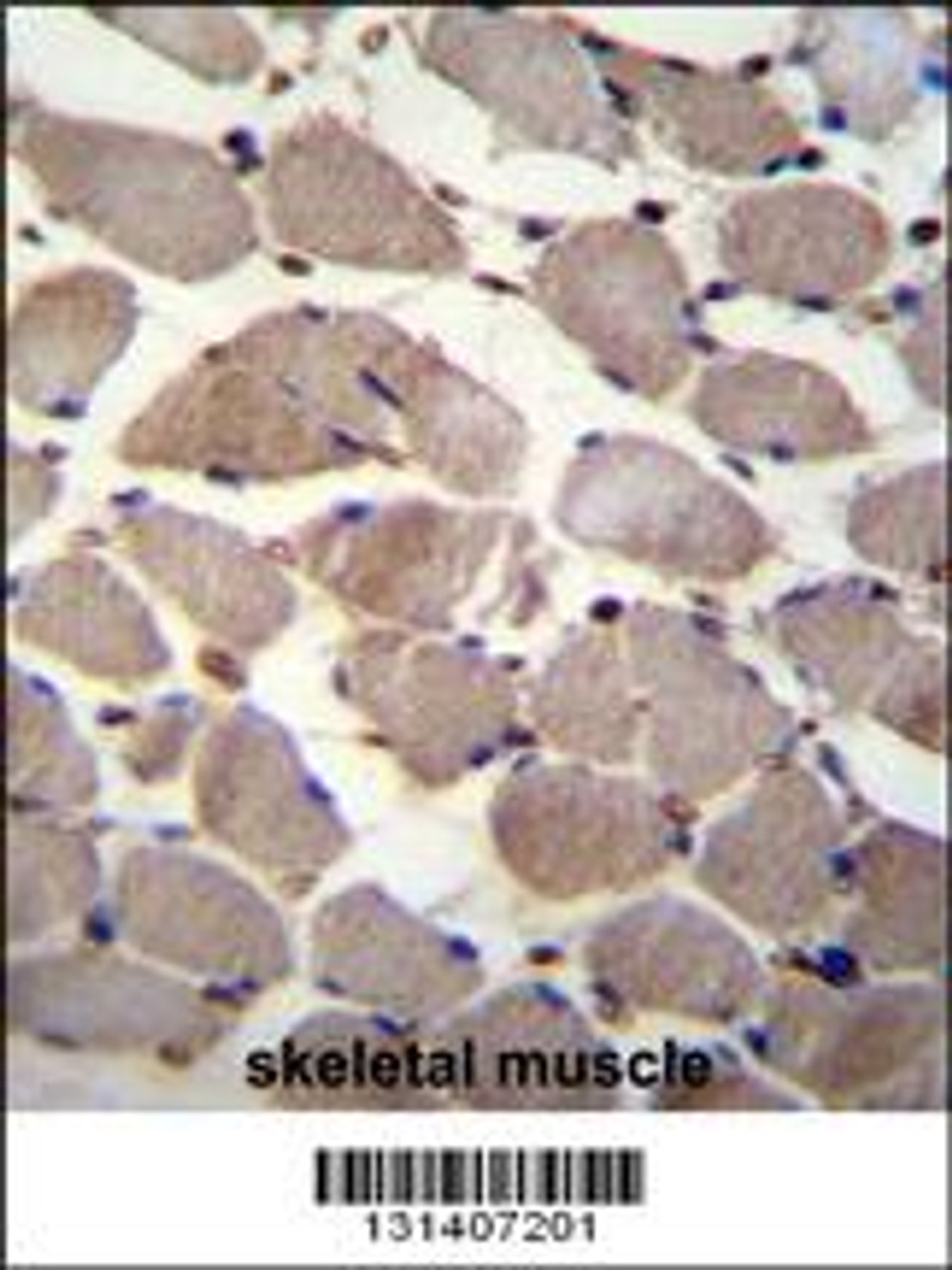 PIK3C2A Antibody immunohistochemistry analysis in formalin fixed and paraffin embedded human skeletal muscle followed by peroxidase conjugation of the secondary antibody and DAB staining.