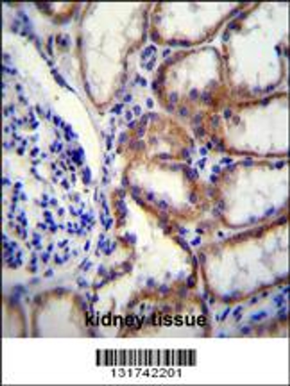 COL8A2 Antibody immunohistochemistry analysis in formalin fixed and paraffin embedded human kidney tissue followed by peroxidase conjugation of the secondary antibody and DAB staining.