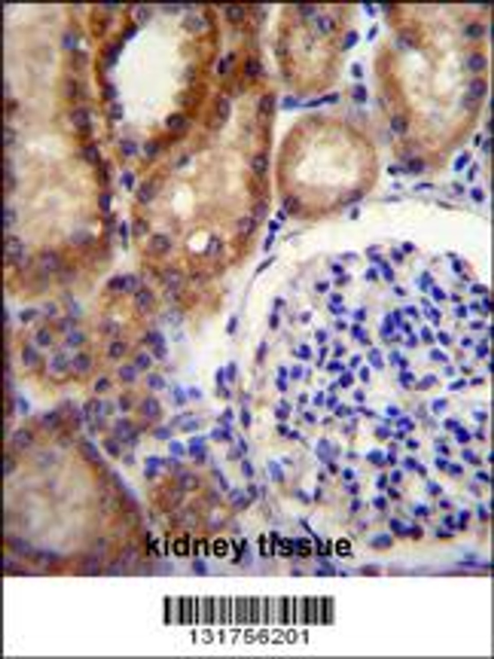 CLCN7 Antibody immunohistochemistry analysis in formalin fixed and paraffin embedded human kidney tissue followed by peroxidase conjugation of the secondary antibody and DAB staining.