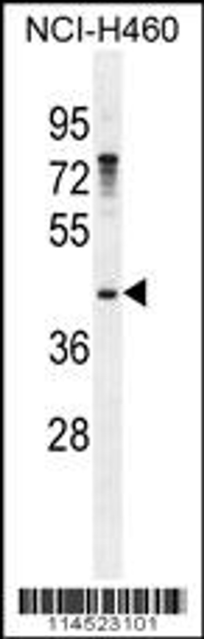 Western blot analysis in NCI-H460 cell line lysates (35ug/lane) .