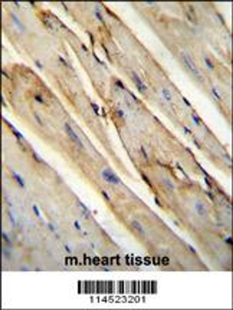 GAS1 Antibody immunohistochemistry analysis in formalin fixed and paraffin embedded mouse heart tissue tissue followed by peroxidase conjugation of the secondary antibody and DAB staining.