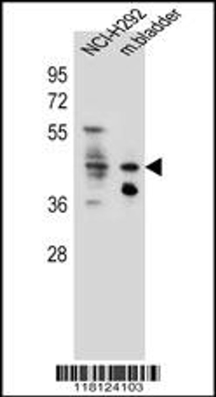 Western blot analysis in NCI-H292 cell line and mouse bladder tissue lysates (35ug/lane) .