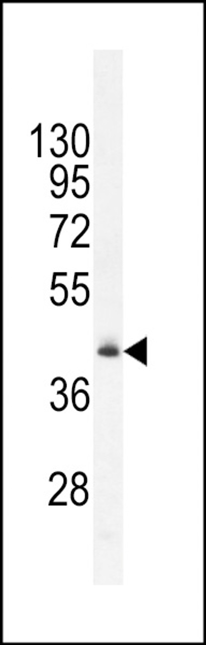 Western blot analysis in mouse heart tissue lysates (35ug/lane) .