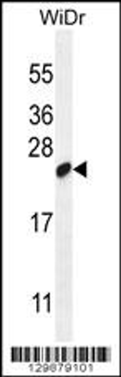 Western blot analysis in WiDr cell line lysates (35ug/lane) .