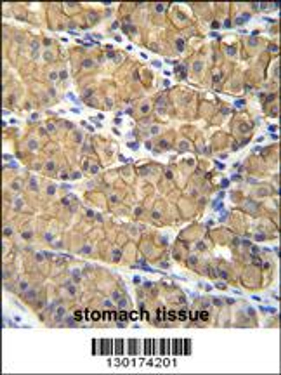 VSIG1 Antibody immunohistochemistry analysis in formalin fixed and paraffin embedded human stomach tissue followed by peroxidase conjugation of the secondary antibody and DAB staining.