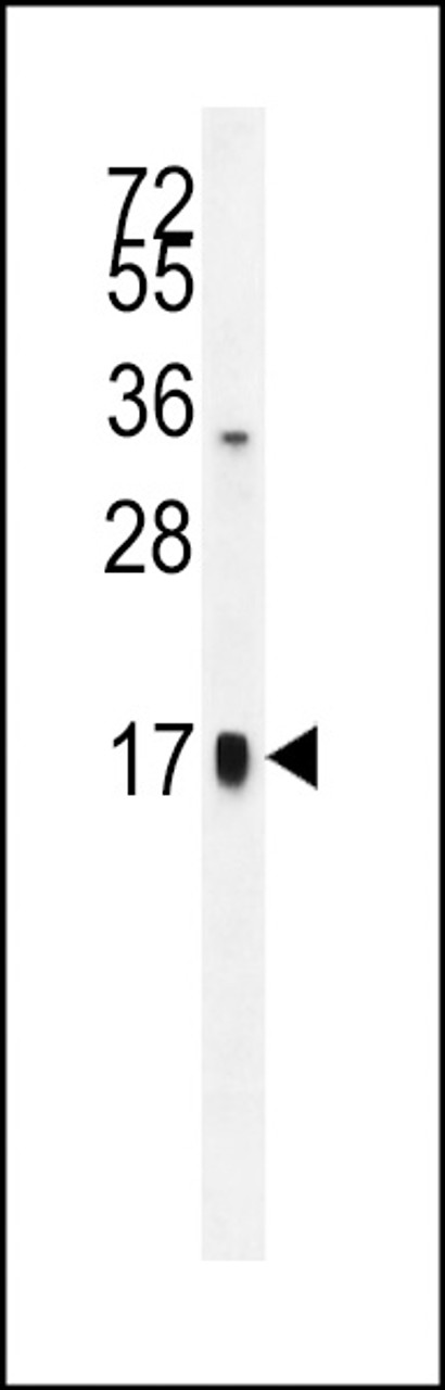 Western blot analysis in HepG2 cell line lysates (35ug/lane) .