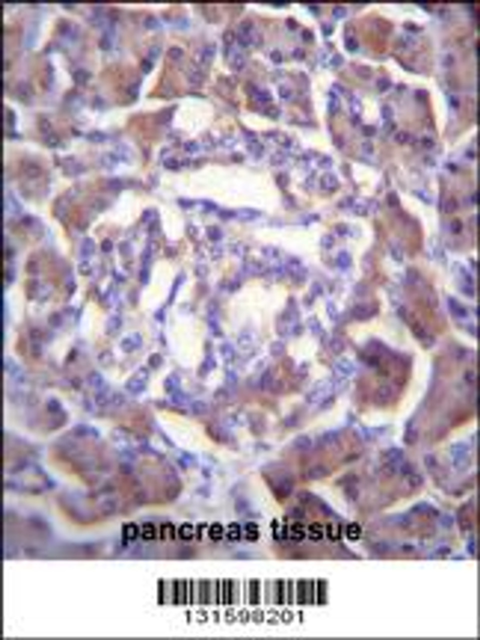 PRSS3 Antibody immunohistochemistry analysis in formalin fixed and paraffin embedded human pancreas tissue followed by peroxidase conjugation of the secondary antibody and DAB staining.