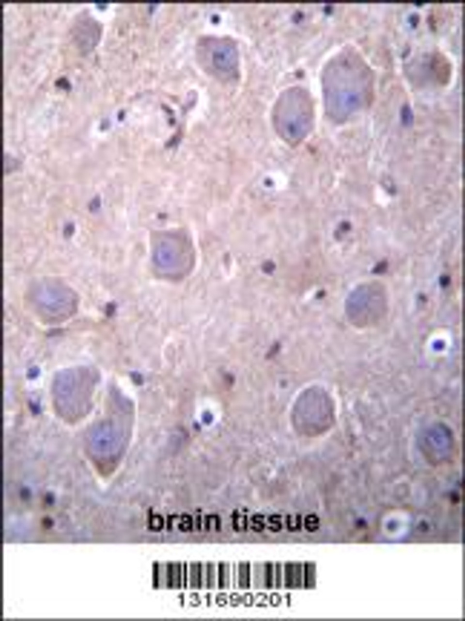 RAP1GDS1 Antibody immunohistochemistry analysis in formalin fixed and paraffin embedded human brain tissue followed by peroxidase conjugation of the secondary antibody and DAB staining.