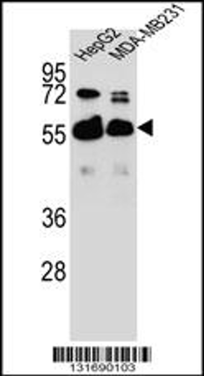 Western blot analysis in HepG2, MDA-MB231 cell line lysates (35ug/lane) .