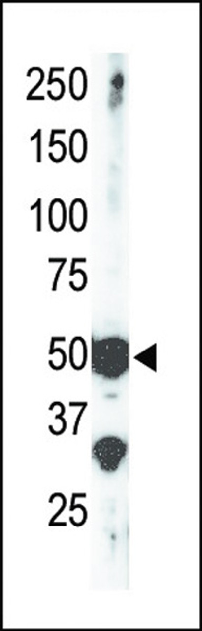 Antibody is used in Western blot to detect SET9 in mouse brain tissue lysate.