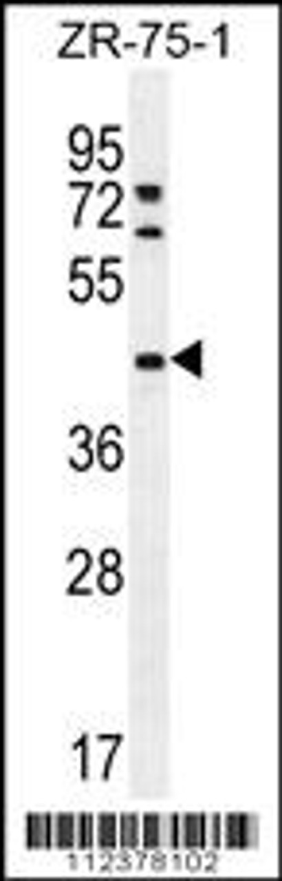 Western blot analysis in ZR-75-1 cell line lysates (35ug/lane) .