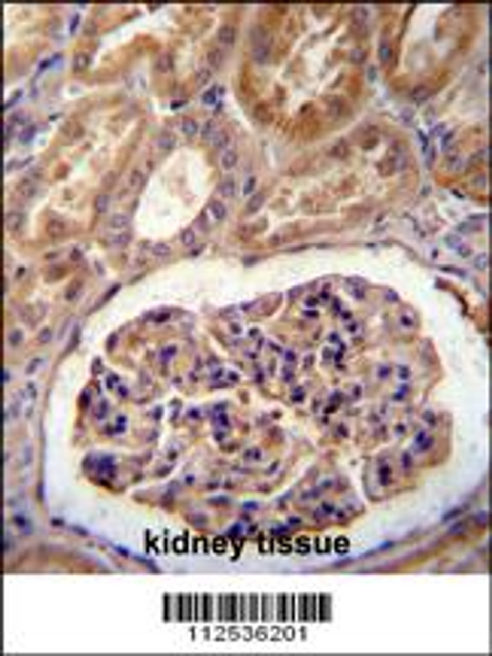MGP Antibody immunohistochemistry analysis in formalin fixed and paraffin embedded human kidney tissue followed by peroxidase conjugation of the secondary antibody and DAB staining.