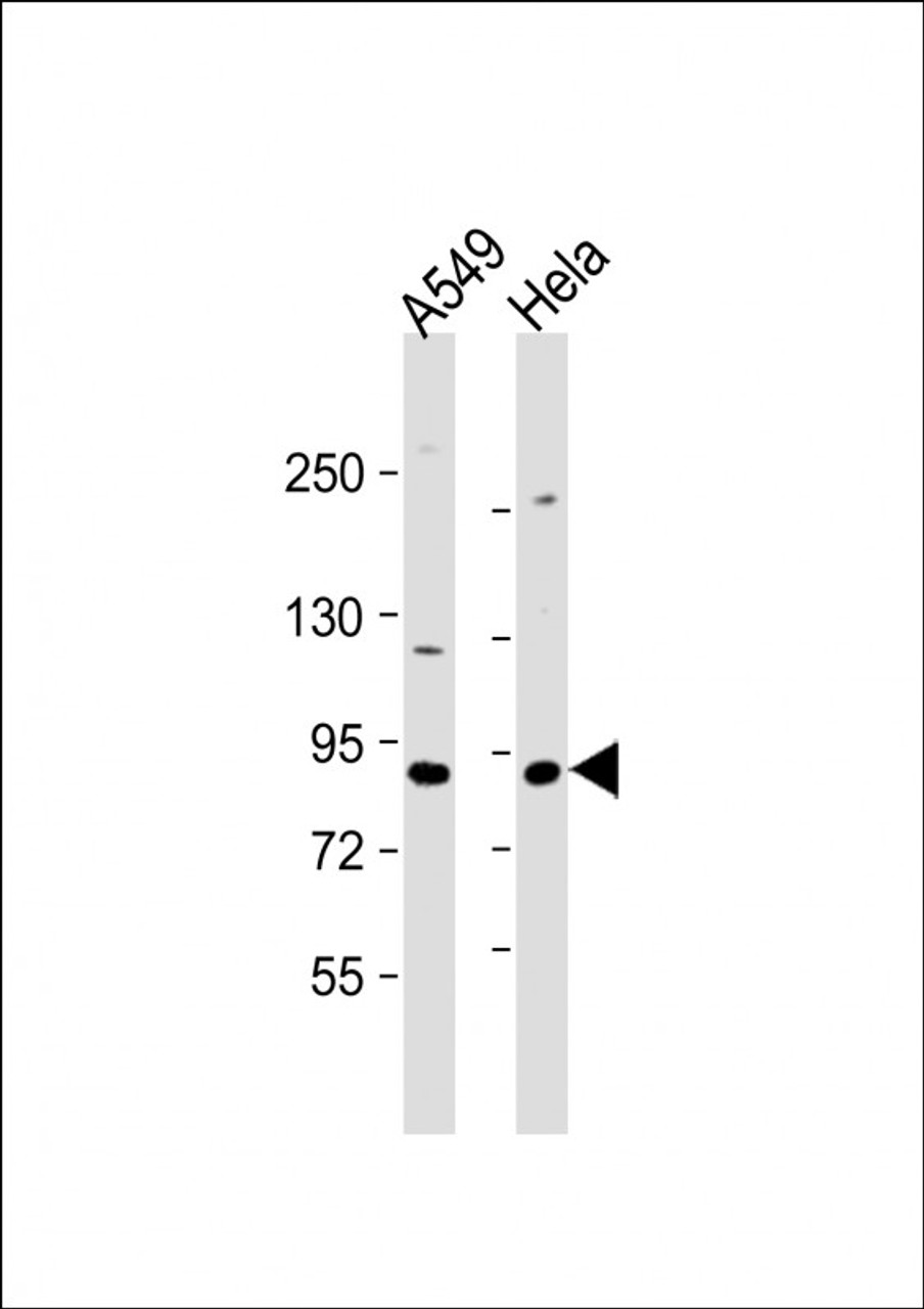 Western Blot at 1:1000 dilution Lane 1: A549 whole cell lysate Lane 2: Hela whole cell lysate Lysates/proteins at 20 ug per lane.