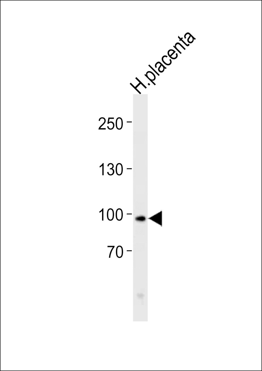 Western blot analysis in human placenta tissue lysates (35ug/lane) .This demonstrates the XRCC5 antibody detected the XRCC5 protein (arrow) .