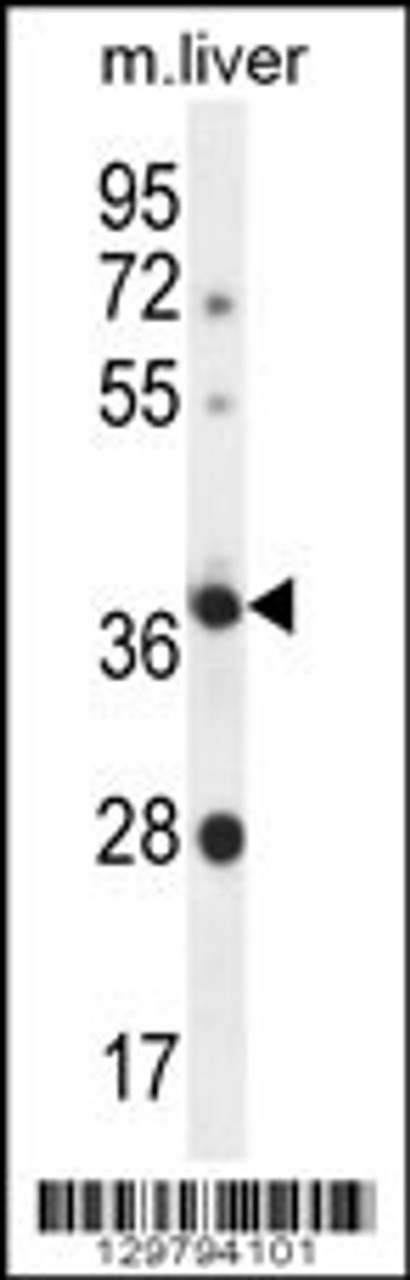 Western blot analysis in mouse liver tissue lysates (35ug/lane) .