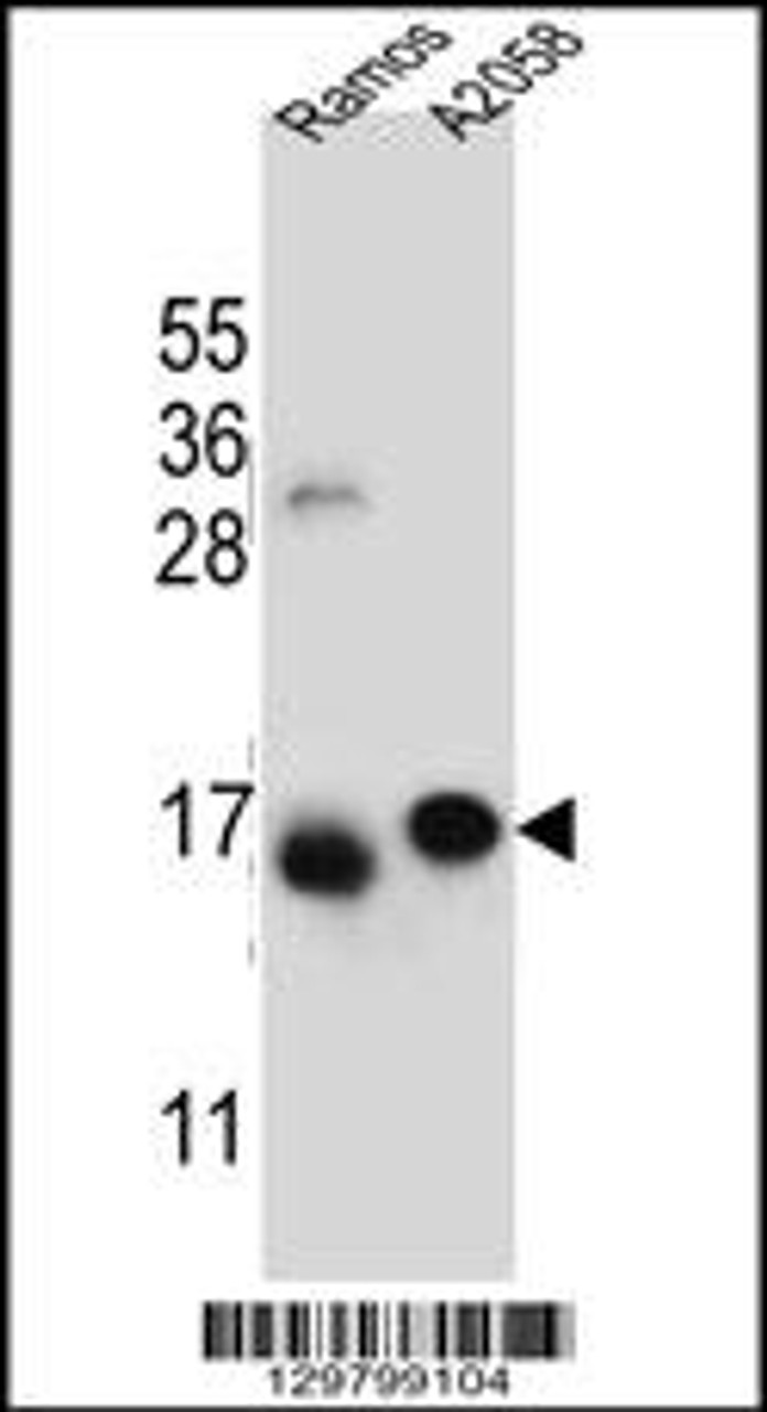 Western blot analysis in Ramos, A2058 cell line lysates (35ug/lane) .