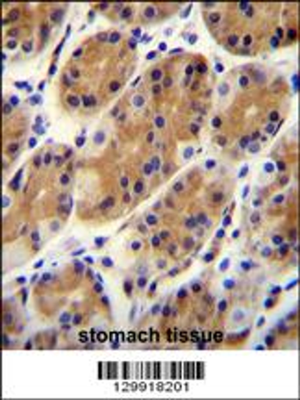 CCDC153 Antibody immunohistochemistry analysis in formalin fixed and paraffin embedded human stomach tissue followed by peroxidase conjugation of the secondary antibody and DAB staining.