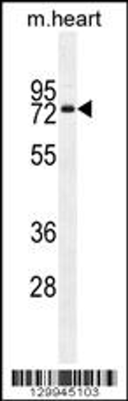 Western blot analysis in mouse heart tissue lysates (35ug/lane) .