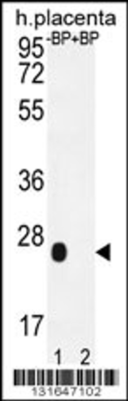 Western blot analysis of OR2J3 Antibody Pab pre-incubated without (lane 1) and with (lane 2) blocking peptide in human placenta tissue lysate.