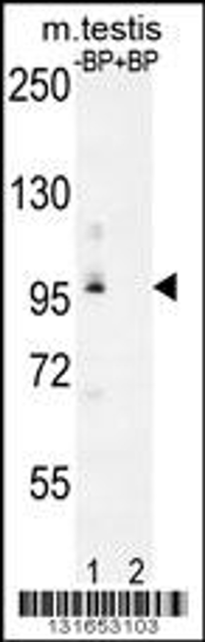 Western blot analysis of PDPR Antibody Pab pre-incubated without (lane 1) and with (lane 2) blocking peptide in mouse testis tissue lysate