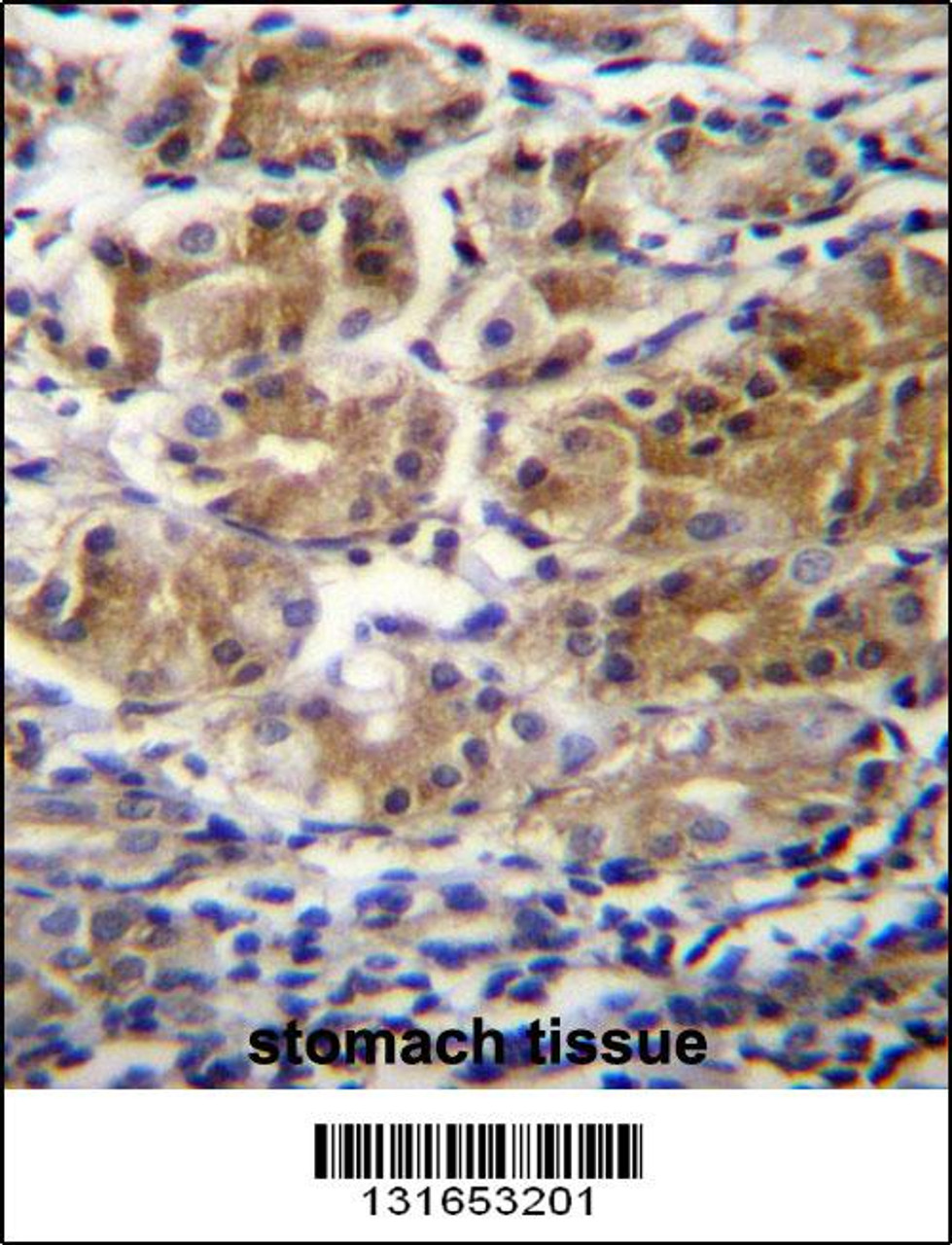 PDPR Antibdy immunohistochemistry analysis in formalin fixed and paraffin embedded human stomach tissue followed by peroxidase conjugation of the secondary antibody and DAB staining.This data demonstrates the use of PDPR Antibdy for immunohistochemistry.