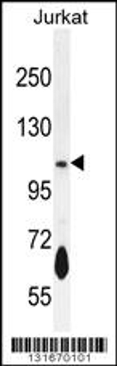 Western blot analysis in Jurkat cell line lysates (35ug/lane) .