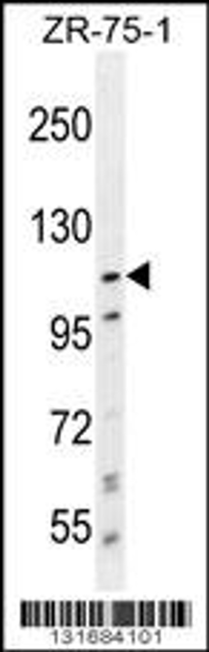 Western blot analysis in ZR-75-1 cell line lysates (35ug/lane) .