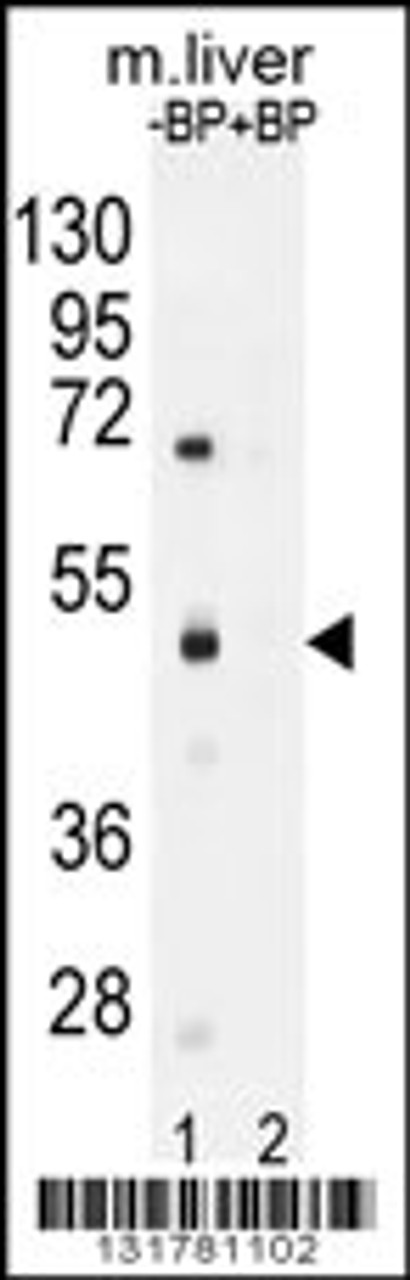 Western blot analysis of SAMD8 Antibody Pab pre-incubated without (lane 1) and with (lane 2) blocking peptide in mouse liver tissue lysate.