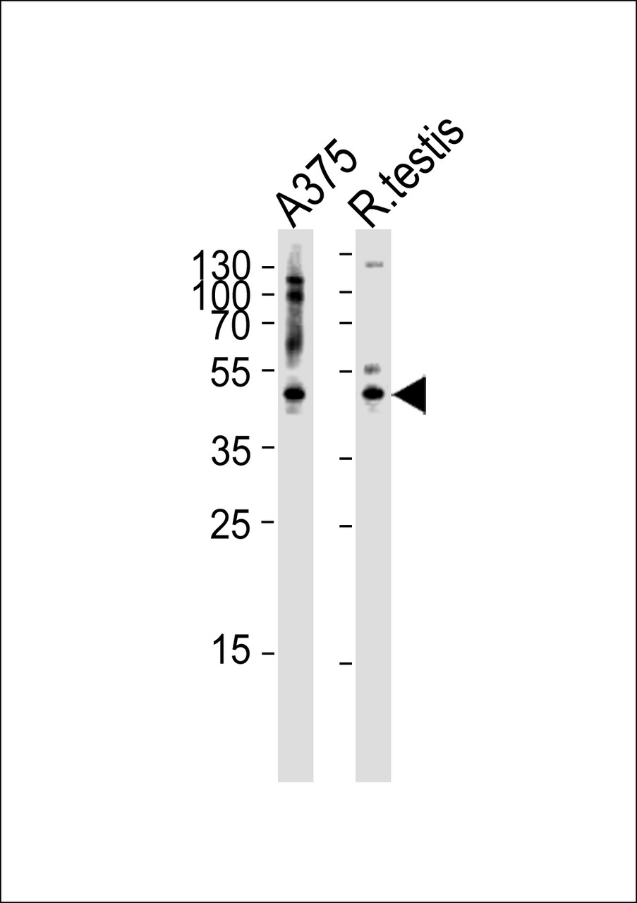 Western blot analysis of lysates from A375 cell line and rat testis tissue lysate (from left to right) , using AP1M1 Antibody at 1:1000 at each lane.