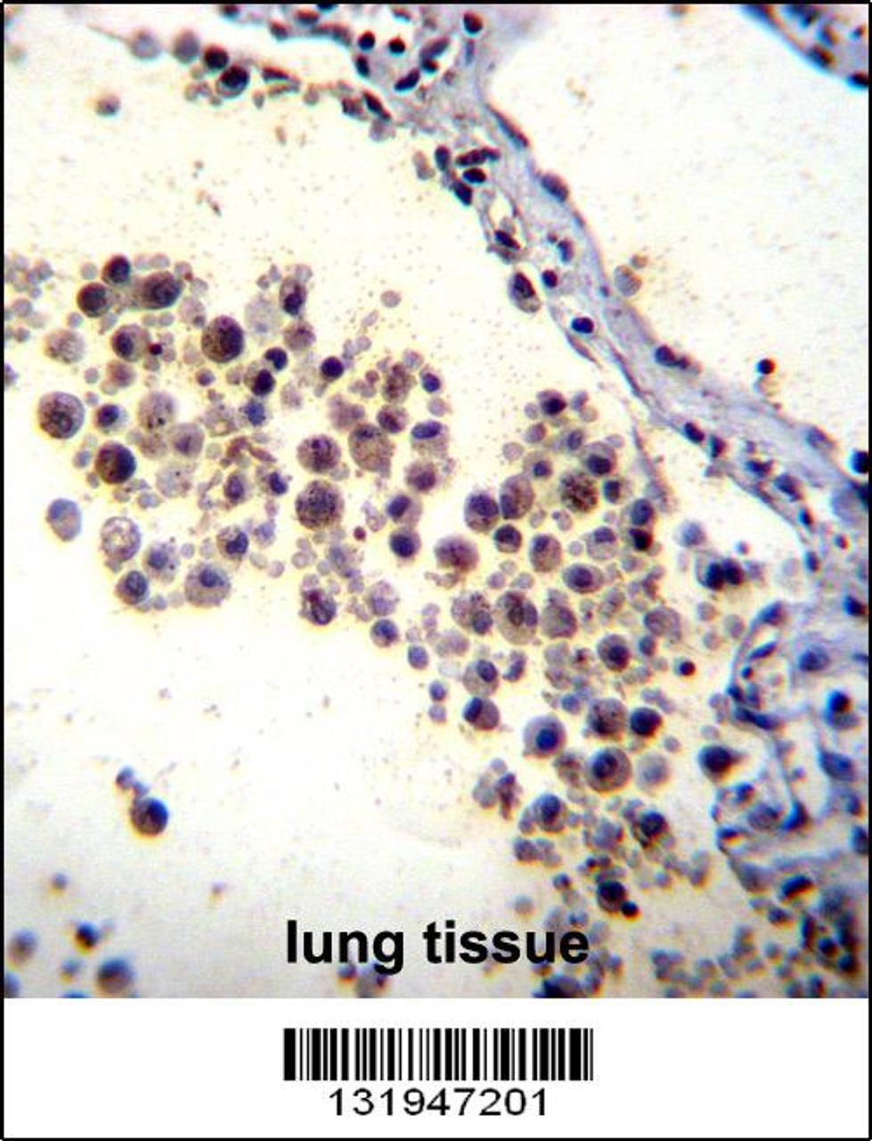 DOK3 Antibody immunohistochemistry analysis in formalin fixed and paraffin embedded human lung tissue followed by peroxidase conjugation of the secondary antibody and DAB staining.