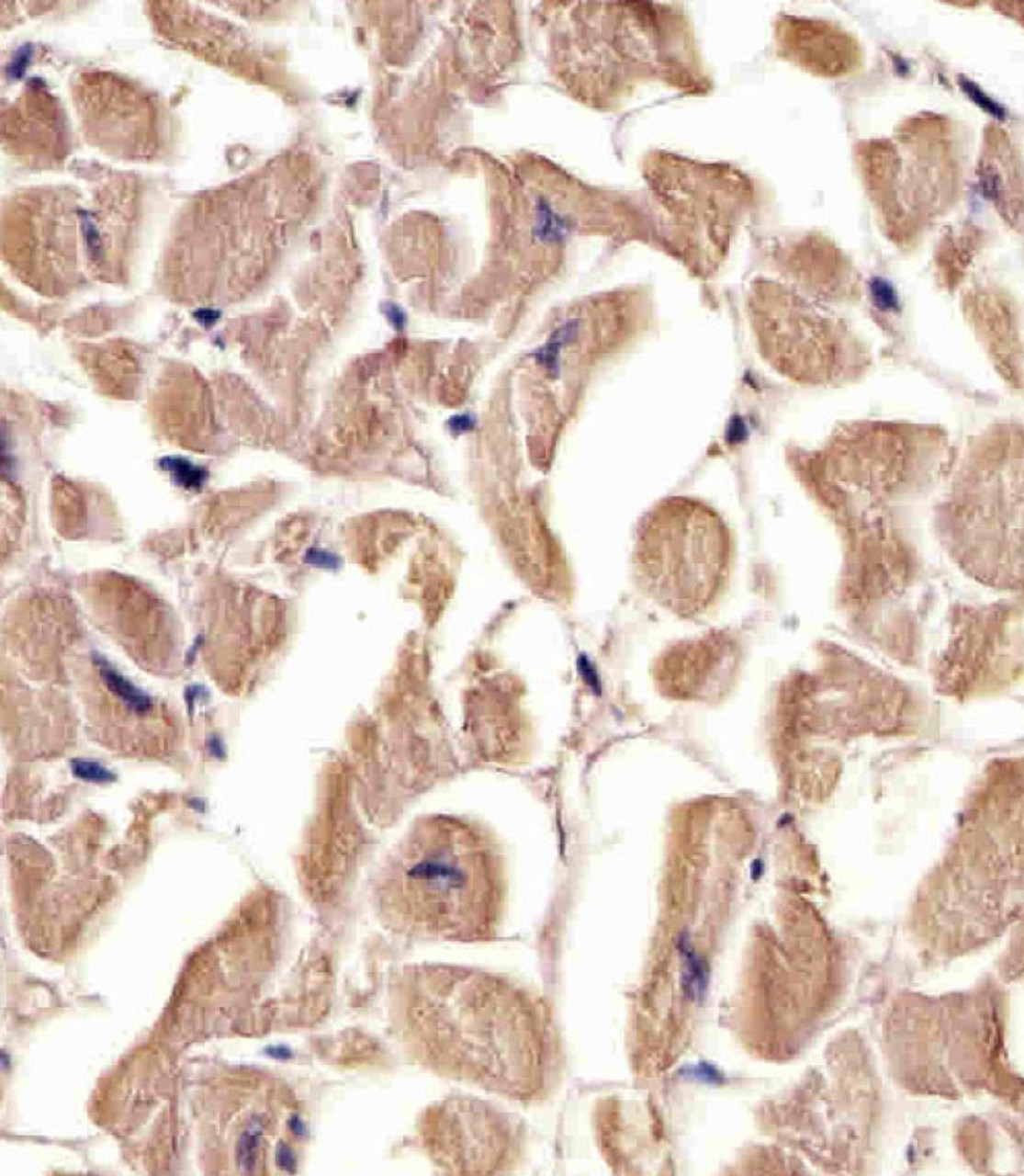 Antibody staining TUBA1C in human heart tissue sections by Immunohistochemistry (IHC-P - paraformaldehyde-fixed, paraffin-embedded sections) .