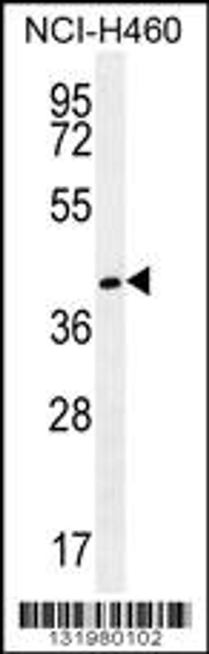 Western blot analysis in NCI-H460 cell line lysates (35ug/lane) .