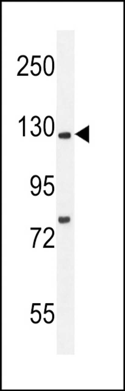 Western blot analysis in mouse brain tissue lysates (35ug/lane) .