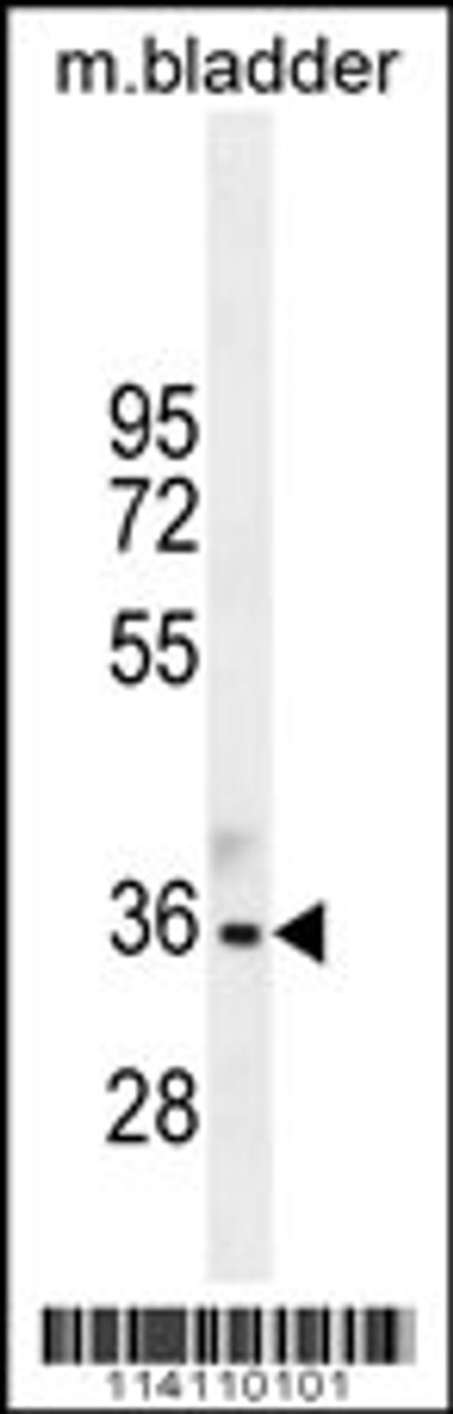 Western blot analysis in mouse bladder tissue lysates (35ug/lane) .This demonstrates the TGIF1 antibody detected the TGIF1 protein (arrow) .