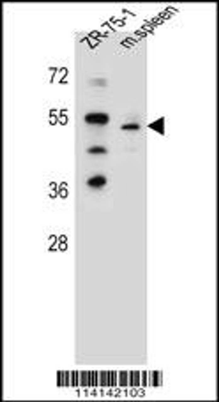 Western blot analysis in ZR-75-1 cell line and mouse spleen tissue lysates (35ug/lane) .