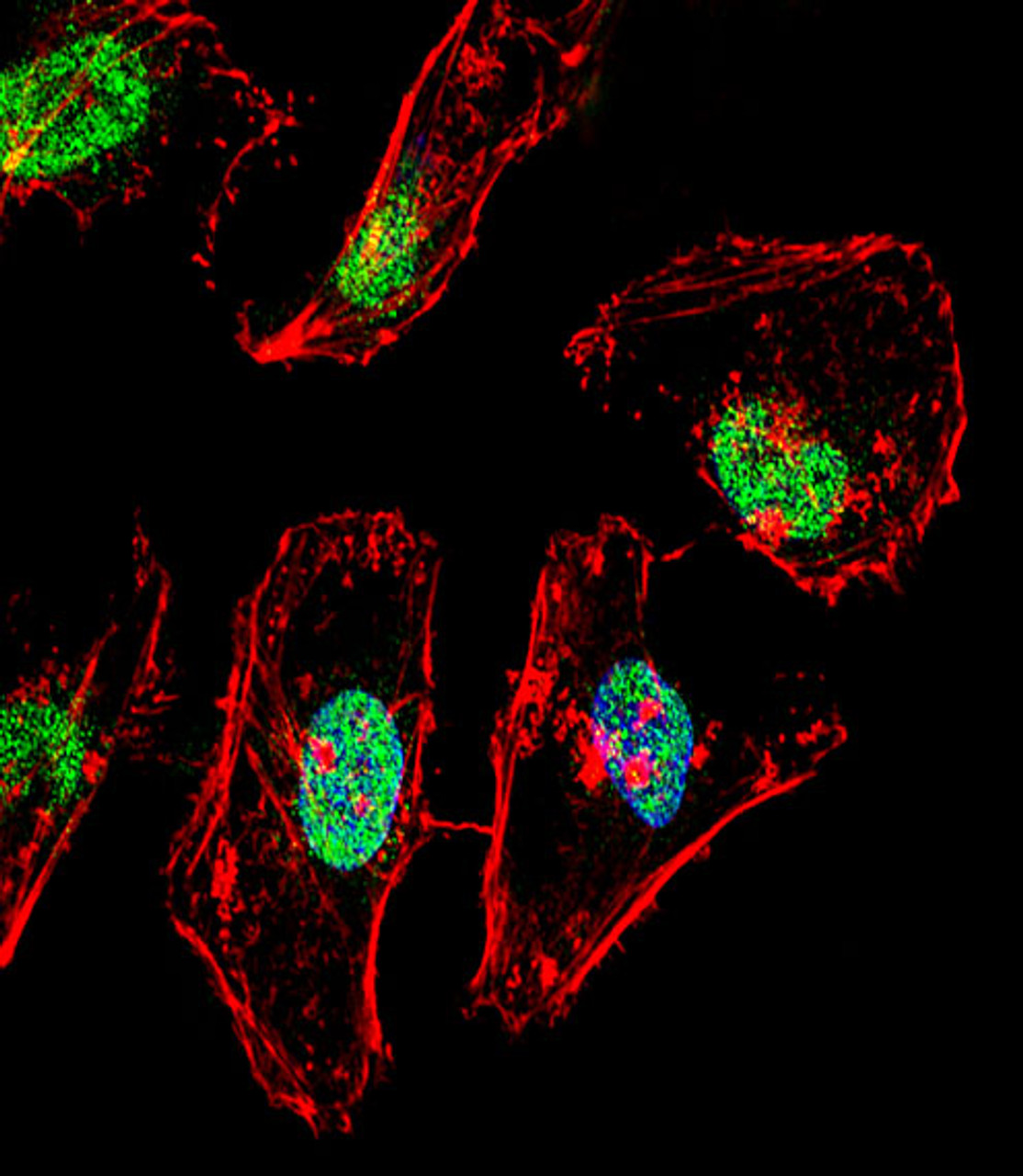 Fluorescent confocal image of Hela cell stained with TBX6 Antibody . Hela cells were fixed with 4% PFA (20 min) , permeabilized with Triton X-100 (0.1%, 10 min) , then incubated with TBX6 primary antibody (1:25) . For secondary antibody, Alexa Fluor 488 conjugated donkey anti-rabbit antibody (green) was used (1:400) .Cytoplasmic actin was counterstained with Alexa Fluor 555 (red) conjugated Phalloidin (7units/ml) . Nuclei were counterstained with DAPI (blue) (10 ug/ml, 10 min) . TBX6 immunoreactivity is localized to nucleus significantly.