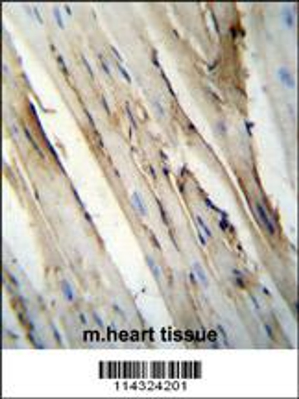 FUT4 Antibody immunohistochemistry analysis in formalin fixed and paraffin embedded mouse heart tissue followed by peroxidase conjugation of the secondary antibody and DAB staining.
