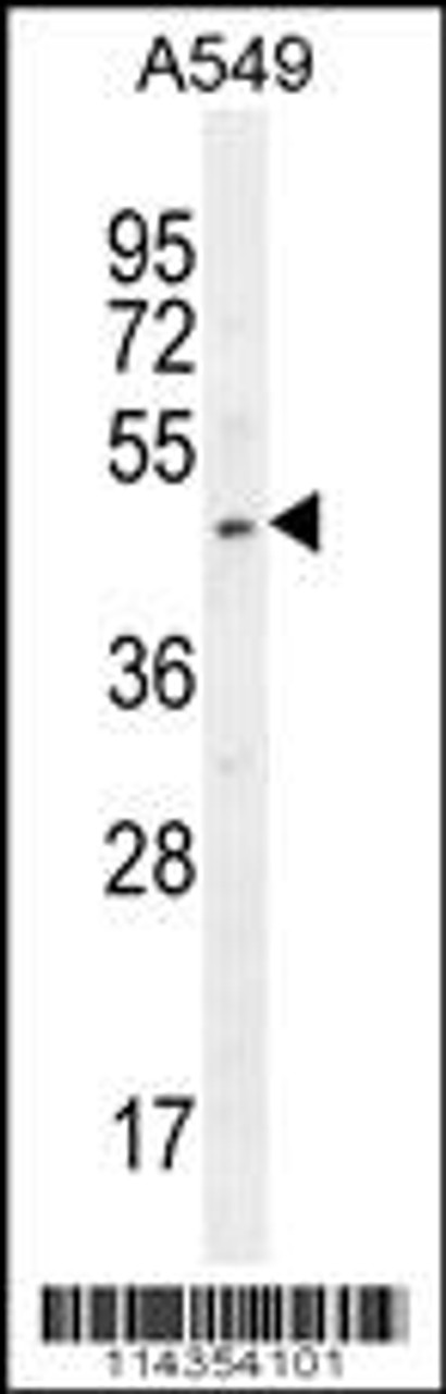 Western blot analysis in A549 cell line lysates (35ug/lane) .This demonstrates the SOX3 antibody detected the SOX3 protein (arrow) .