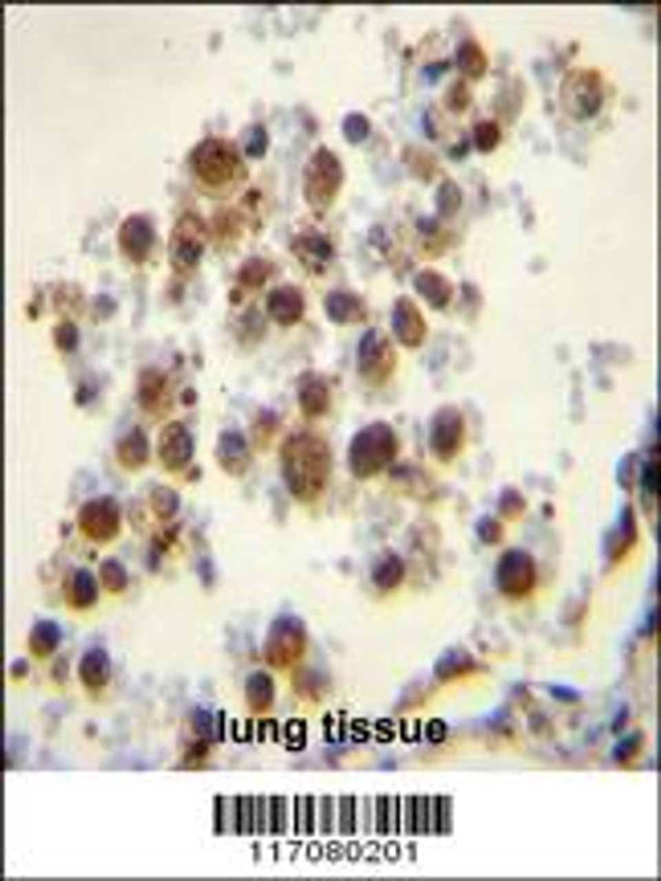 CYP5A1 Antibody immunohistochemistry analysis in formalin fixed and paraffin embedded human lung tissue followed by peroxidase conjugation of the secondary antibody and DAB staining.