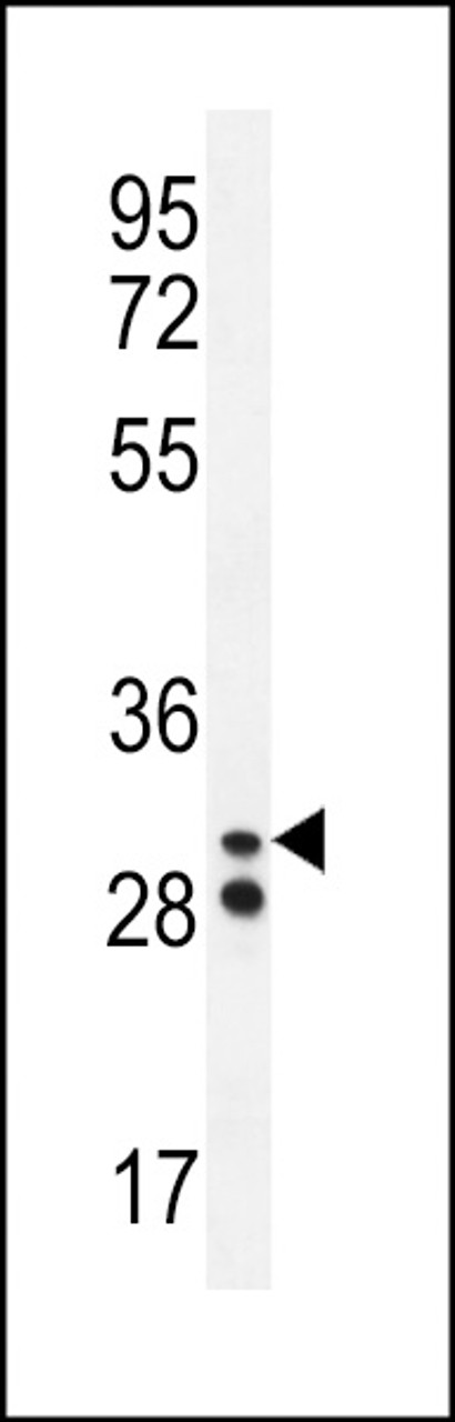 Western blot analysis in A2058 cell line lysates (35ug/lane) .This demonstrates the Neutrophil elastase antibody detected the Neutrophil elastase protein (arrow) .